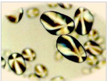 شکل ظاهر گرانول نشاسته سیب زمینی در زیر میکروسکوپ